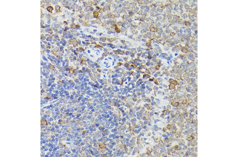 Immunohistochemistry - Anti-Caspase-3 Antibody (A13916) - Antibodies.com