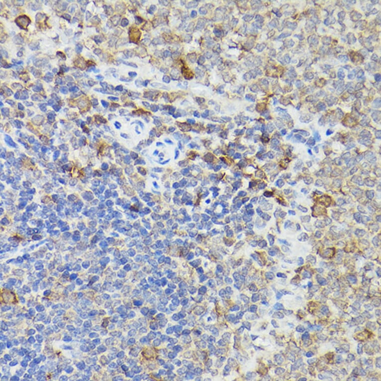 Immunohistochemistry - Anti-Caspase-3 Antibody (A13916) - Antibodies.com