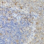 Immunohistochemistry - Anti-Caspase-3 Antibody (A13916) - Antibodies.com