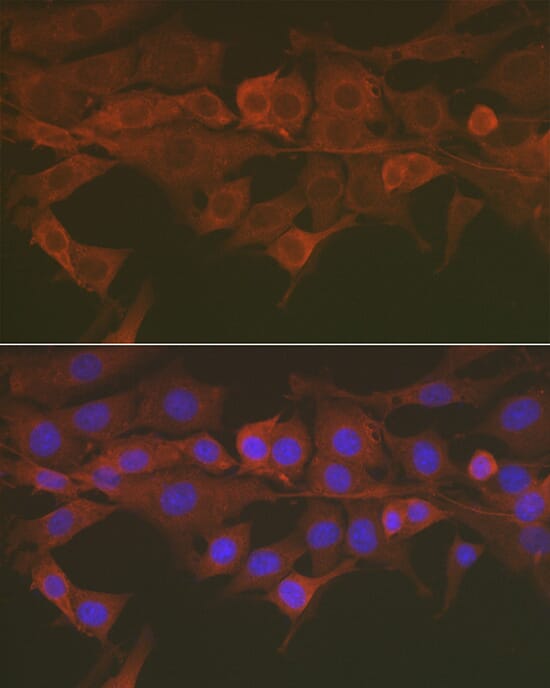 あ様 Anti-Caspase-3 Antibody (A13916) | Antibodies.com