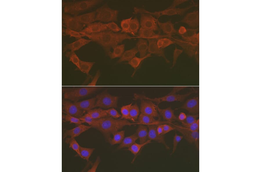 Immunofluorescence - Anti-Caspase-3 Antibody (A13916) - Antibodies.com