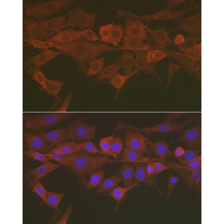 Immunofluorescence - Anti-Caspase-3 Antibody (A13916) - Antibodies.com