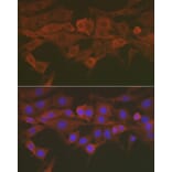 Immunofluorescence - Anti-Caspase-3 Antibody (A13916) - Antibodies.com