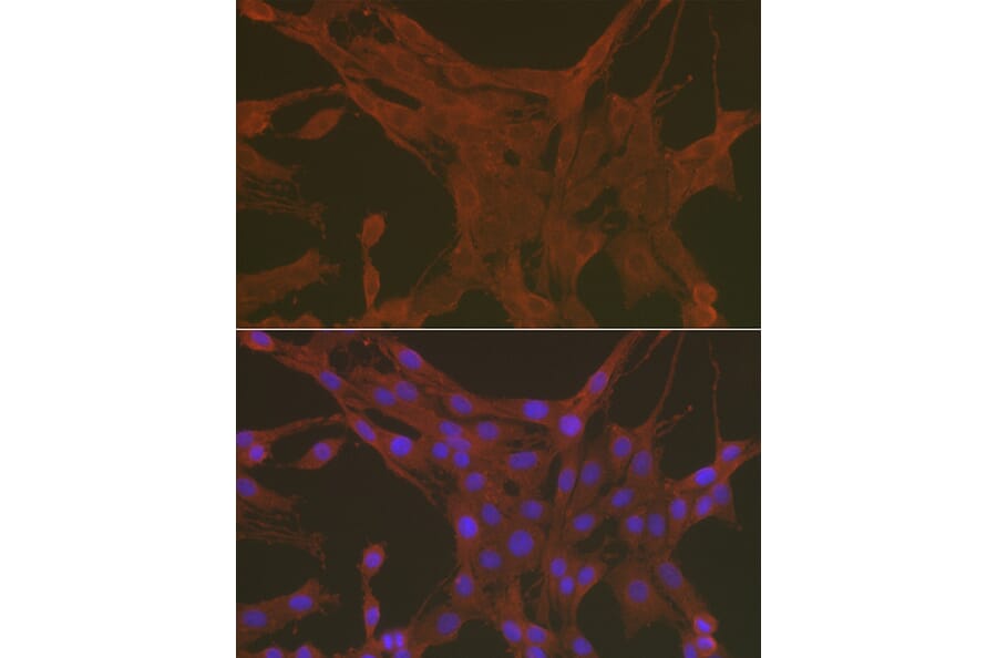 Immunofluorescence - Anti-Caspase-3 Antibody (A13916) - Antibodies.com