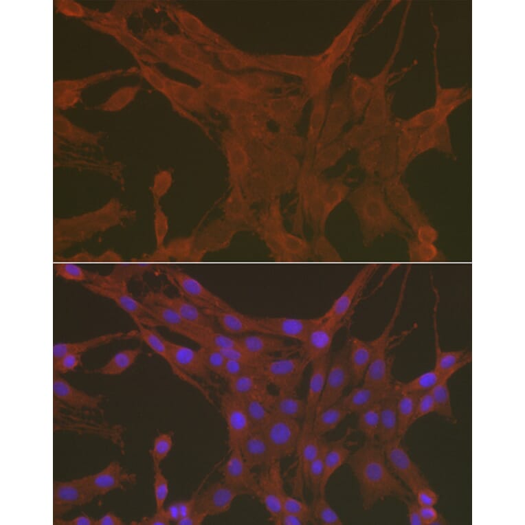 Immunofluorescence - Anti-Caspase-3 Antibody (A13916) - Antibodies.com