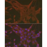 Immunofluorescence - Anti-Caspase-3 Antibody (A13916) - Antibodies.com
