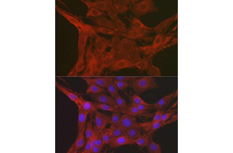 Immunofluorescence - Anti-Caspase-3 Antibody (A13916) - Antibodies.com