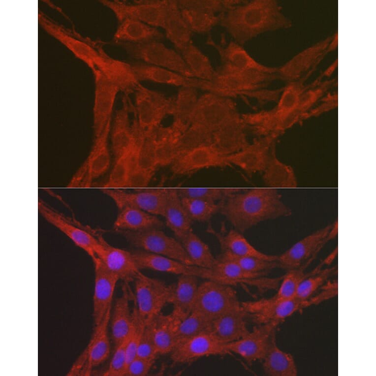 Immunofluorescence - Anti-Caspase-3 Antibody (A13916) - Antibodies.com