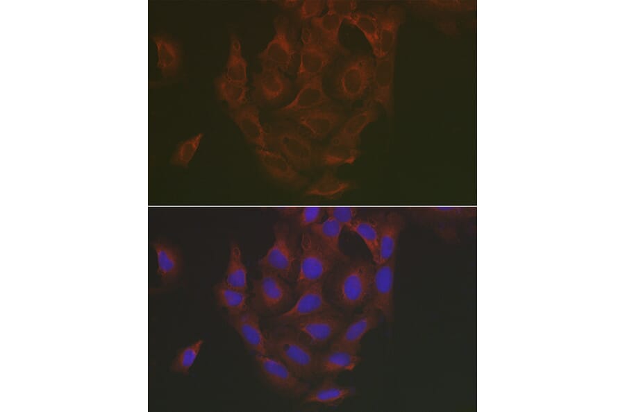 Immunofluorescence - Anti-Caspase-3 Antibody (A13916) - Antibodies.com