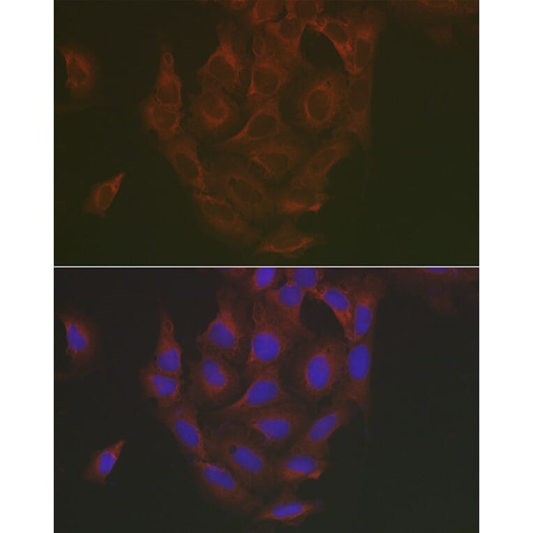 Immunofluorescence - Anti-Caspase-3 Antibody (A13916) - Antibodies.com