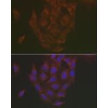 Immunofluorescence - Anti-Caspase-3 Antibody (A13916) - Antibodies.com