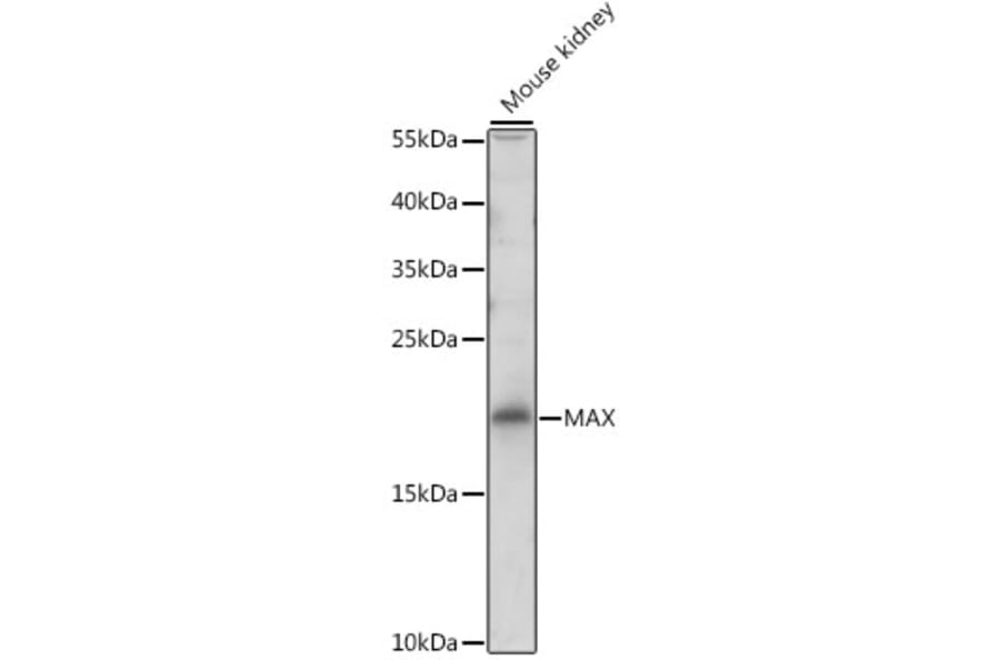 Western Blot - Anti-MAX Antibody (A13917) - Antibodies.com