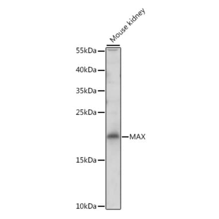 Western Blot - Anti-MAX Antibody (A13917) - Antibodies.com