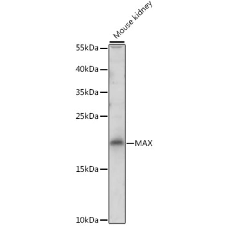 Western Blot - Anti-MAX Antibody (A13917) - Antibodies.com