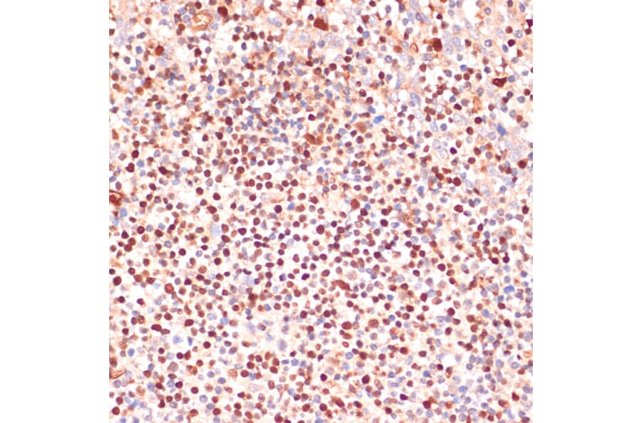Immunohistochemistry - Anti-5 Lipoxygenase/5-LO Antibody (A13918) - Antibodies.com