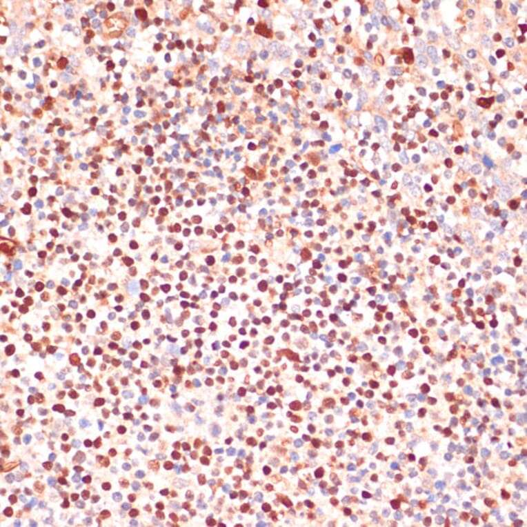 Immunohistochemistry - Anti-5 Lipoxygenase/5-LO Antibody (A13918) - Antibodies.com