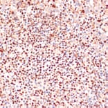 Immunohistochemistry - Anti-5 Lipoxygenase/5-LO Antibody (A13918) - Antibodies.com