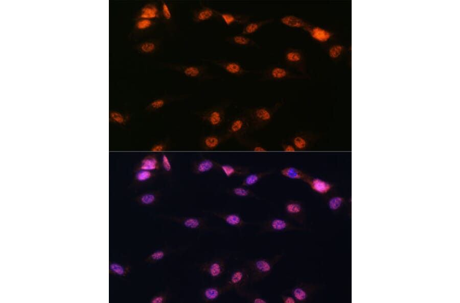 Immunofluorescence - Anti-5 Lipoxygenase/5-LO Antibody (A13918) - Antibodies.com