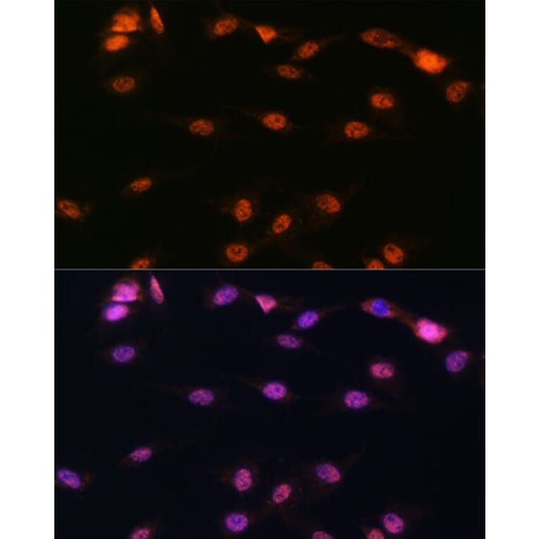 Immunofluorescence - Anti-5 Lipoxygenase/5-LO Antibody (A13918) - Antibodies.com