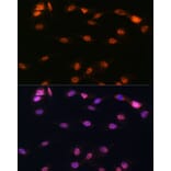 Immunofluorescence - Anti-5 Lipoxygenase/5-LO Antibody (A13918) - Antibodies.com
