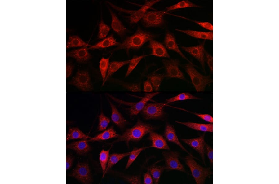 Immunofluorescence - Anti-CYP1A1 Antibody (A13919) - Antibodies.com