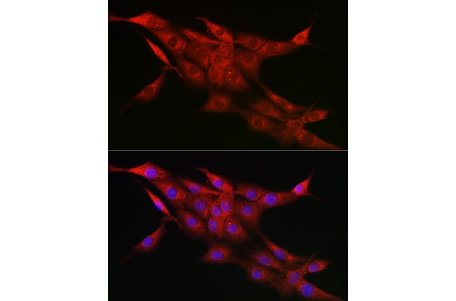 Immunofluorescence - Anti-CYP1A1 Antibody (A13919) - Antibodies.com