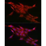Immunofluorescence - Anti-CYP1A1 Antibody (A13919) - Antibodies.com