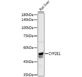 Western Blot - Anti-Cytochrome P450 2E1 Antibody (A13920) - Antibodies.com