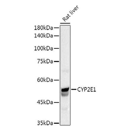Western Blot - Anti-Cytochrome P450 2E1 Antibody (A13920) - Antibodies.com