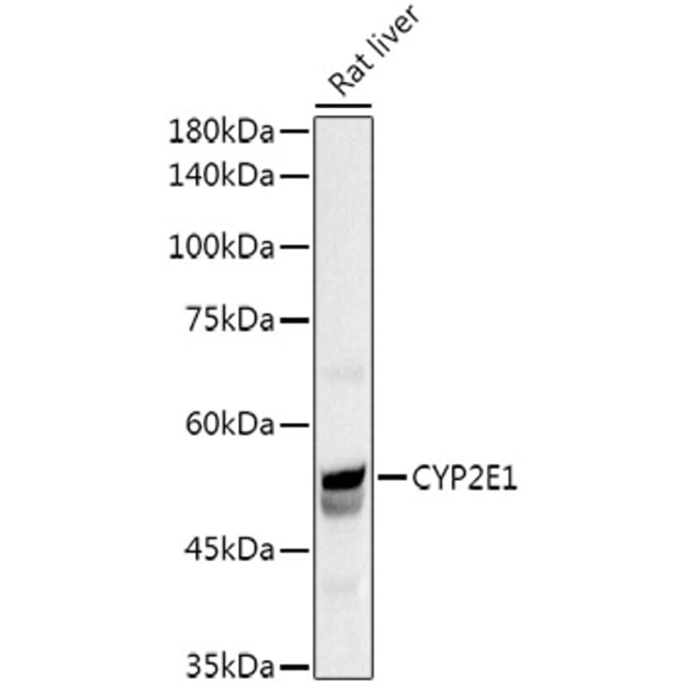 Western Blot - Anti-Cytochrome P450 2E1 Antibody (A13920) - Antibodies.com