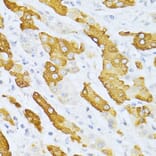 Immunohistochemistry - Anti-Cytochrome P450 2E1 Antibody (A13920) - Antibodies.com