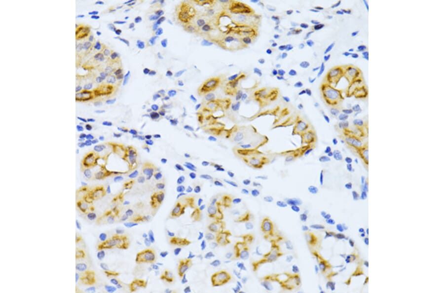 Immunohistochemistry - Anti-Cytochrome P450 2E1 Antibody (A13920) - Antibodies.com