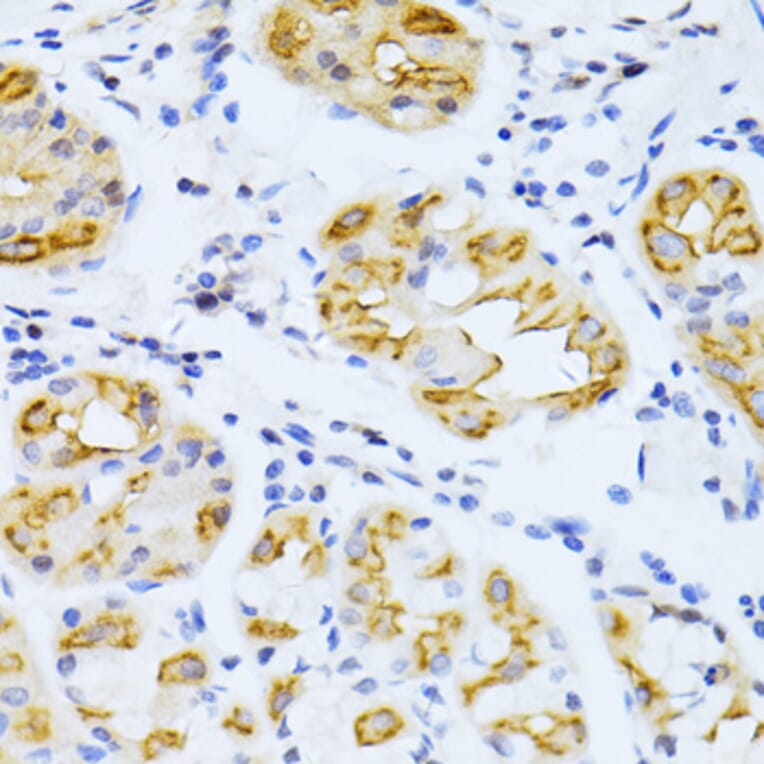 Immunohistochemistry - Anti-Cytochrome P450 2E1 Antibody (A13920) - Antibodies.com