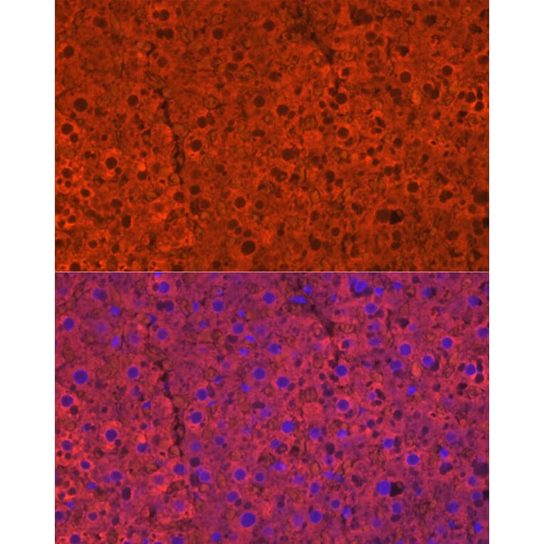 Immunofluorescence - Anti-Cytochrome P450 2E1 Antibody (A13920) - Antibodies.com