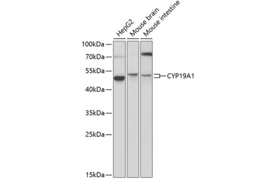 Western Blot - Anti-CYP19A1 Antibody (A2161) - Antibodies.com