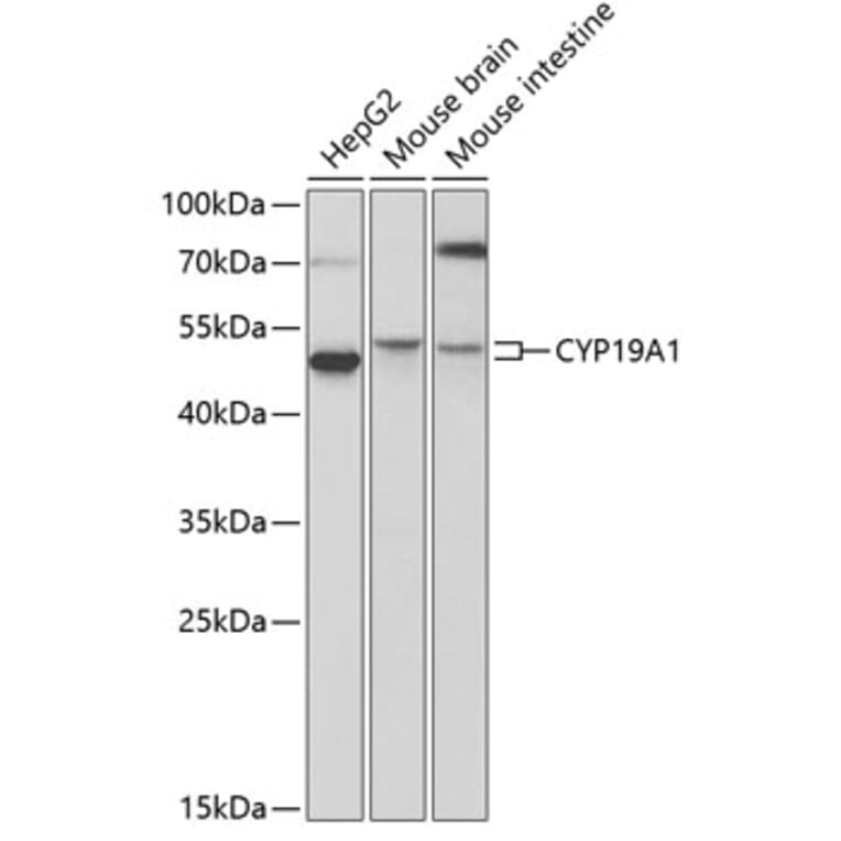 Western Blot - Anti-CYP19A1 Antibody (A2161) - Antibodies.com