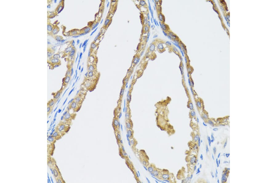 Immunohistochemistry - Anti-CYP19A1 Antibody (A2161) - Antibodies.com