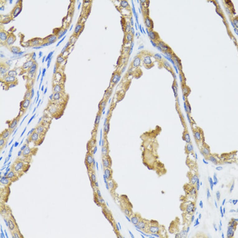 Immunohistochemistry - Anti-CYP19A1 Antibody (A2161) - Antibodies.com