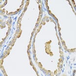 Immunohistochemistry - Anti-CYP19A1 Antibody (A2161) - Antibodies.com