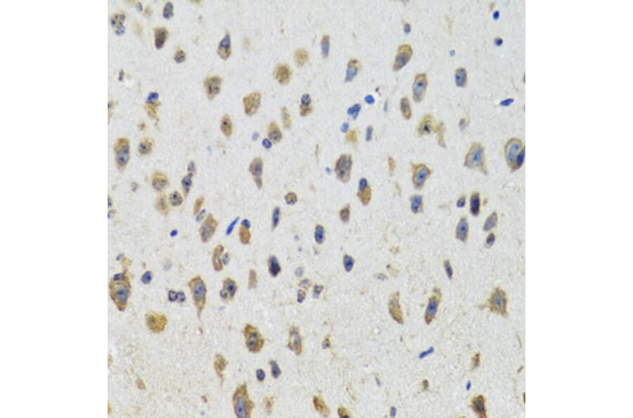Immunohistochemistry - Anti-CYP19A1 Antibody (A2161) - Antibodies.com