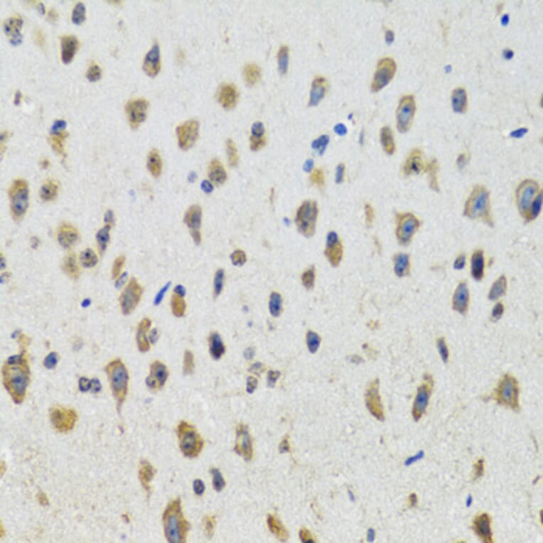 Immunohistochemistry - Anti-CYP19A1 Antibody (A2161) - Antibodies.com