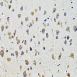 Immunohistochemistry - Anti-CYP19A1 Antibody (A2161) - Antibodies.com