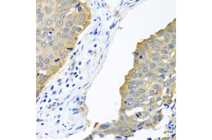 Immunohistochemistry - Anti-eIF4E Antibody (A13922) - Antibodies.com