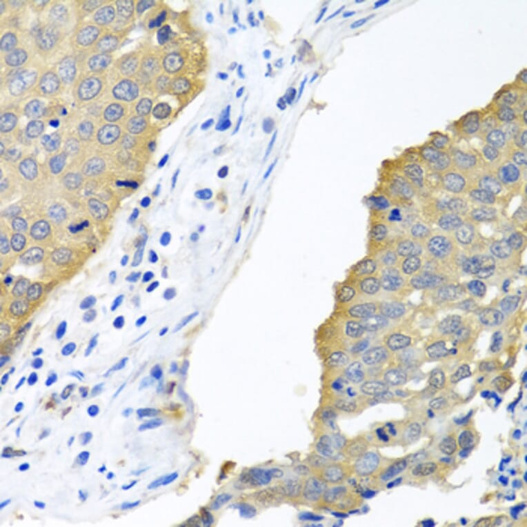 Immunohistochemistry - Anti-eIF4E Antibody (A13922) - Antibodies.com