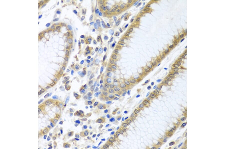 Immunohistochemistry - Anti-eIF4E Antibody (A13922) - Antibodies.com