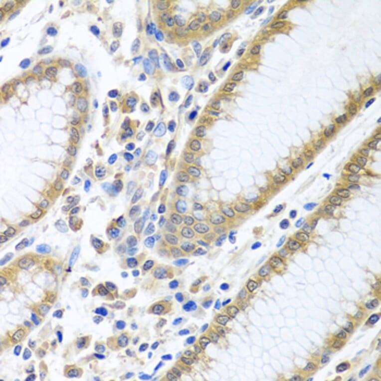 Immunohistochemistry - Anti-eIF4E Antibody (A13922) - Antibodies.com