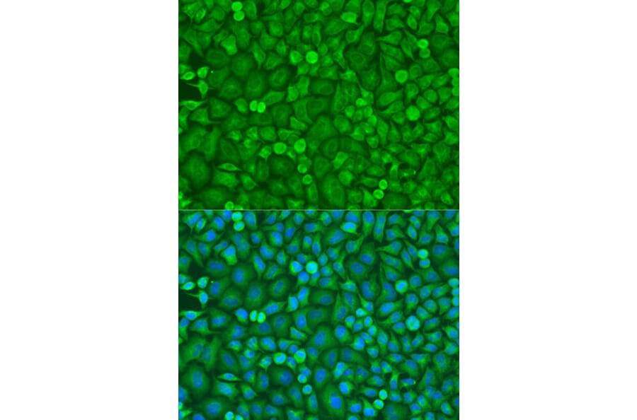 Immunofluorescence - Anti-eIF4E Antibody (A13922) - Antibodies.com