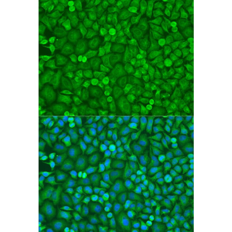 Immunofluorescence - Anti-eIF4E Antibody (A13922) - Antibodies.com