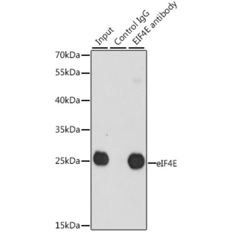 Western Blot - Anti-eIF4E Antibody (A13922) - Antibodies.com