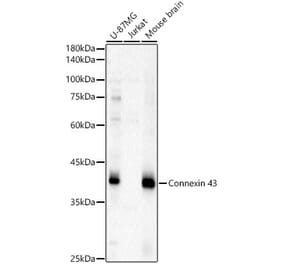 Western Blot - Anti-Connexin 43 / GJA1 Antibody (A13923) - Antibodies.com